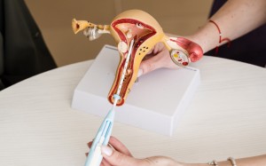 Inseminación Intrauterina